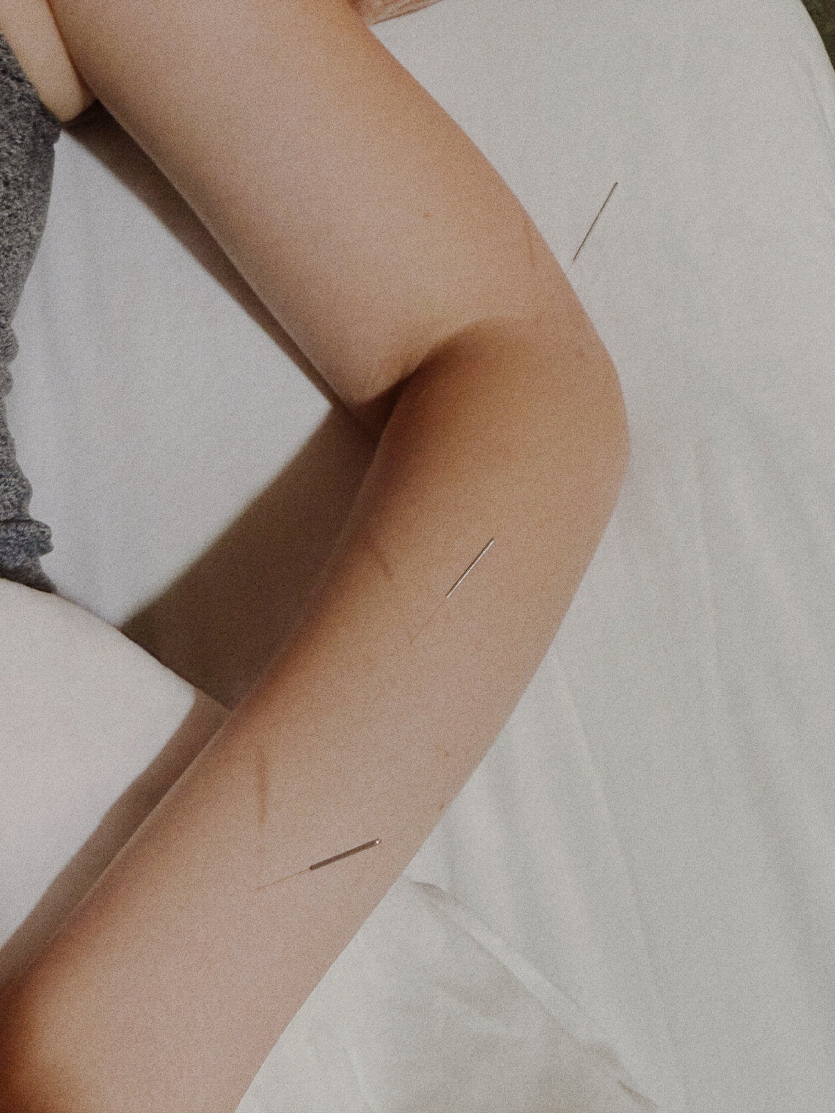 Acupuncture Rituals