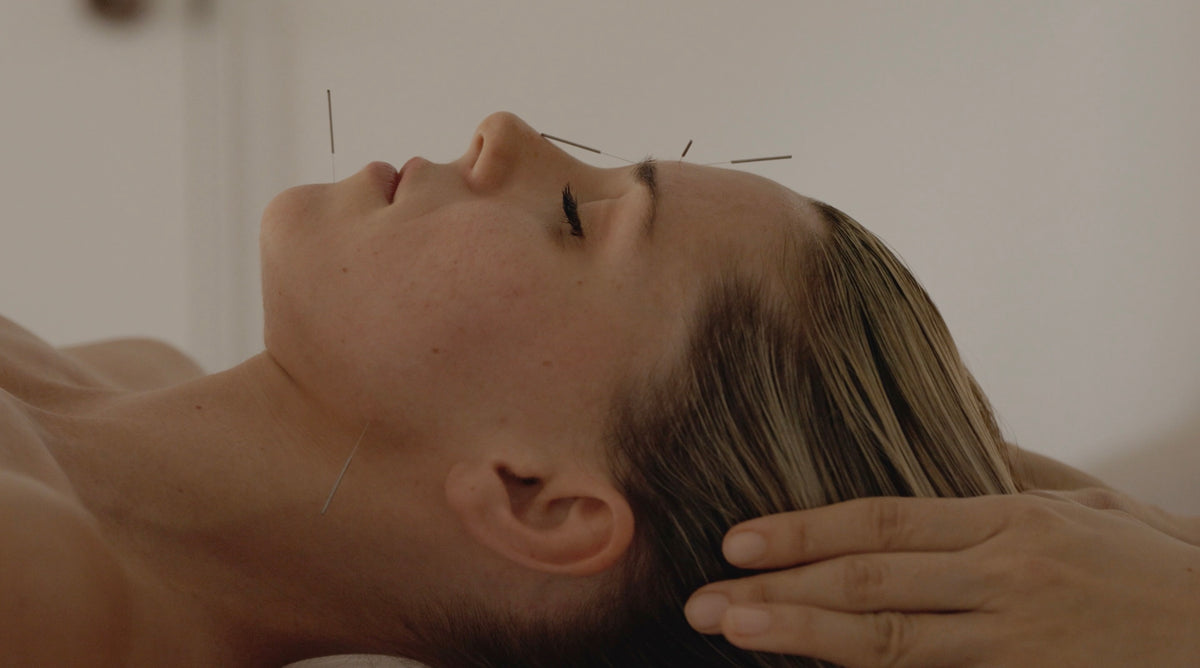 Beauty Cosmetic Acupuncture