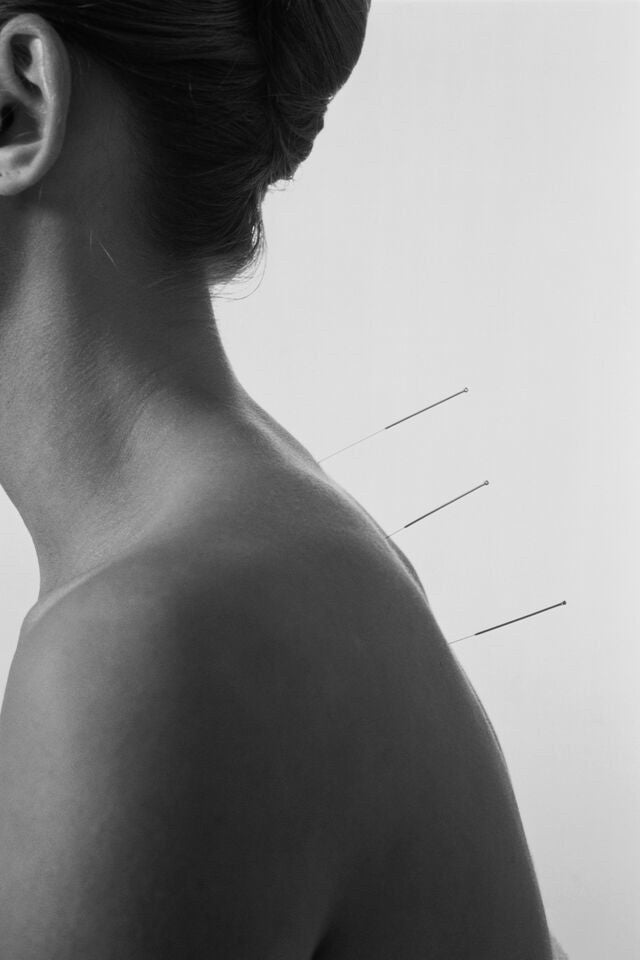 Beauty Acupuncture