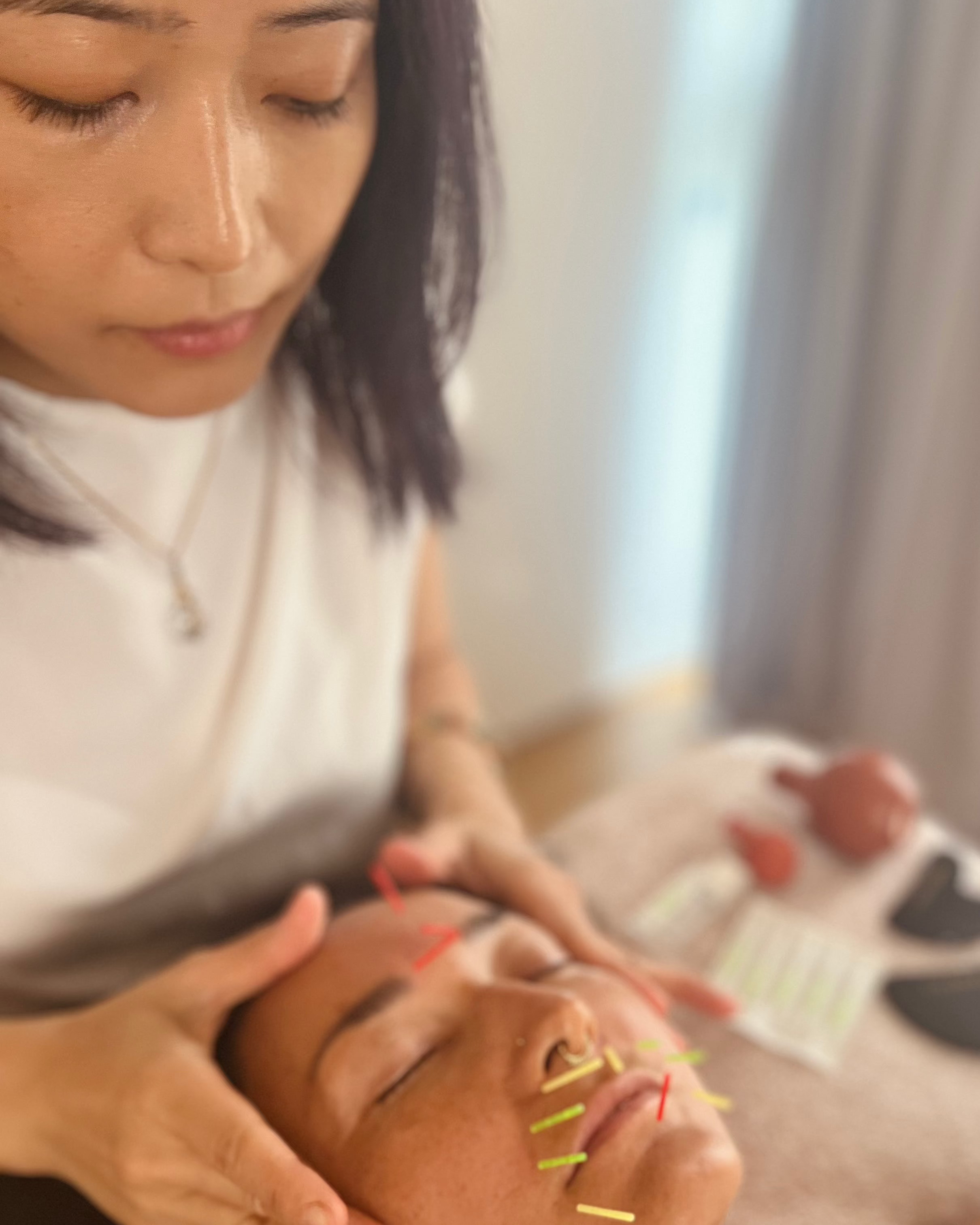 Beauty Acupuncture