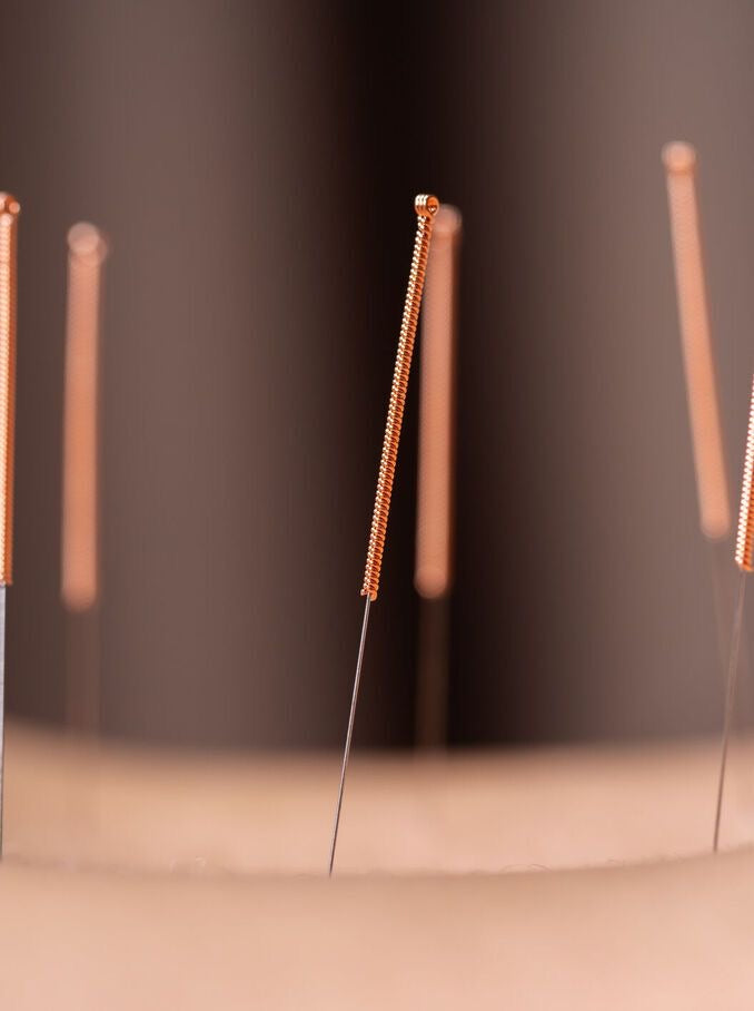 acupuncture pins on skin up close