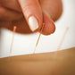 acupuncture pins on skin 